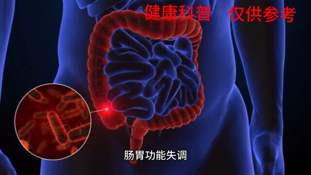 植物神经紊乱导致胃肠神经官能症