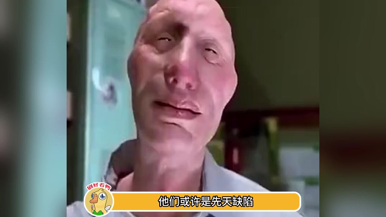 中国畸形秀图片