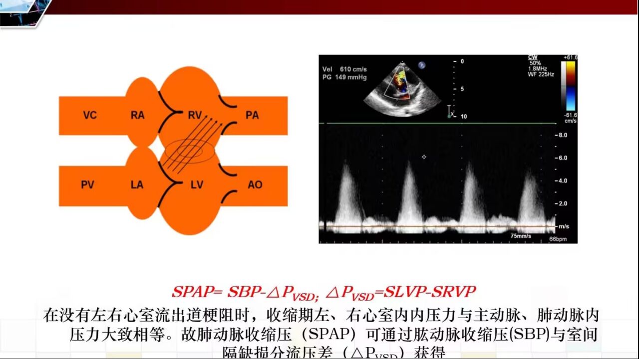 超声心动图在危急重症医学中的应用ppt