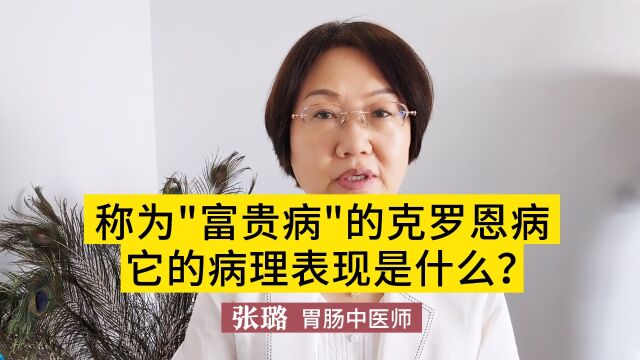 被称为“富贵病”的克罗恩病,它的病理表现是什么?医生一次说明白!