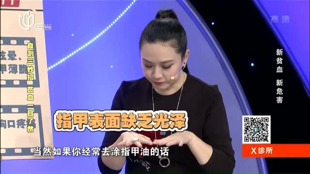 从指甲就能看出你是否贫血