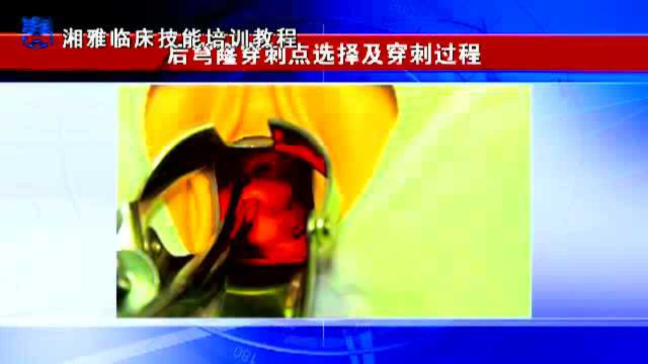 湘雅临床培训：后穹窿穿刺点选择及穿刺过程_高清