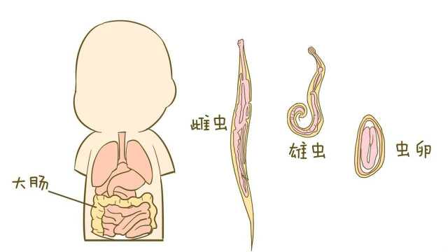 孩子出现这几种情况说明肚子生蛔虫了,妈妈千万别忽视!赶紧治疗吧