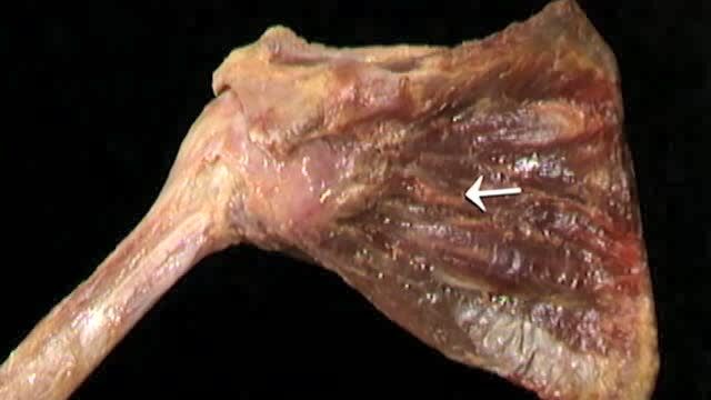 艾氏人体解剖学 上肢 1-1-10 肩部肌肉复习