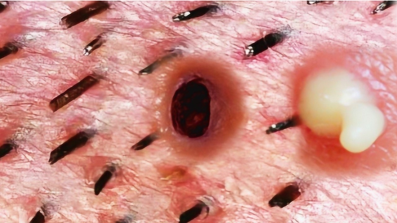 肉眼无法看到的东西显微镜下人的脸部这么多寄生虫你敢看吗