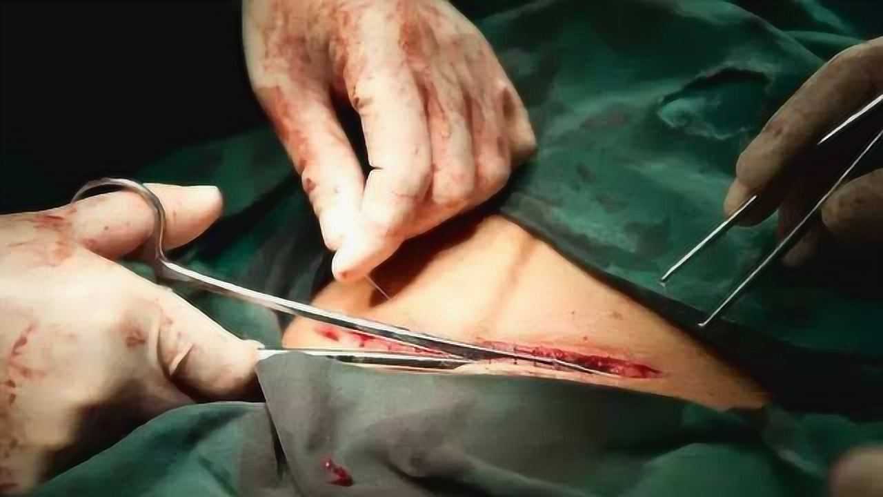 20岁女孩怀胎9个月去世婆婆坚持要剖开肚子医生开刀后蒙了