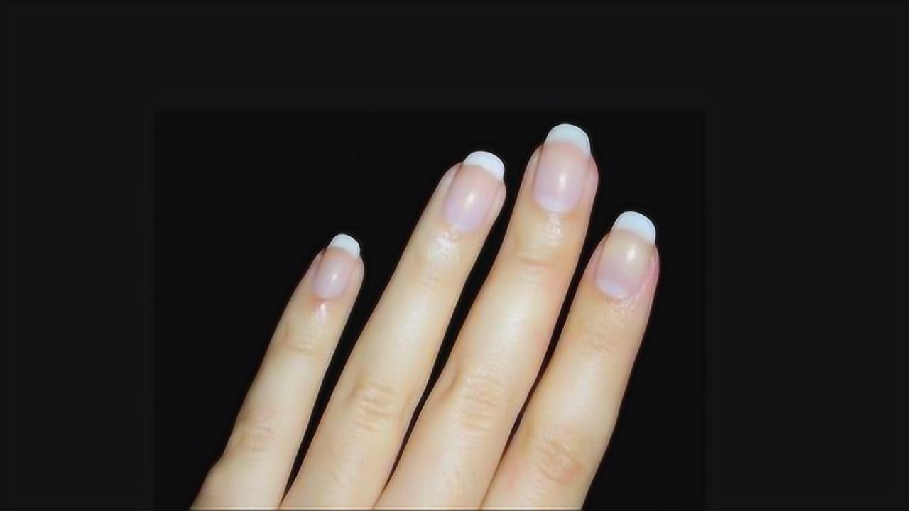如果手上没有小月牙,身体就会很差劲吗?看专家怎么解释!