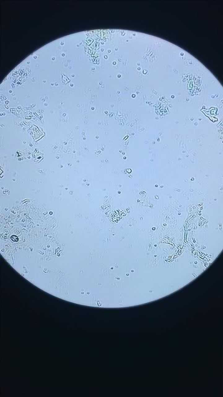 感冒时流出的鼻涕,放在显微镜下观察,流动中的物质是什么