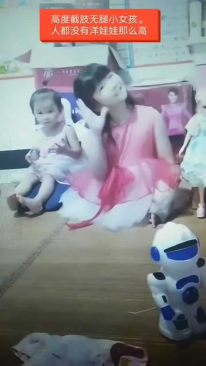 高度截肢无腿小女孩人都没有洋娃娃那么高