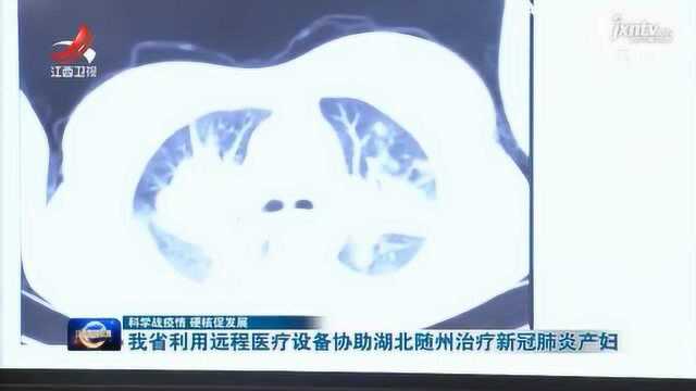 我省利用远程医疗设备协助湖北随州治疗新冠肺炎产妇