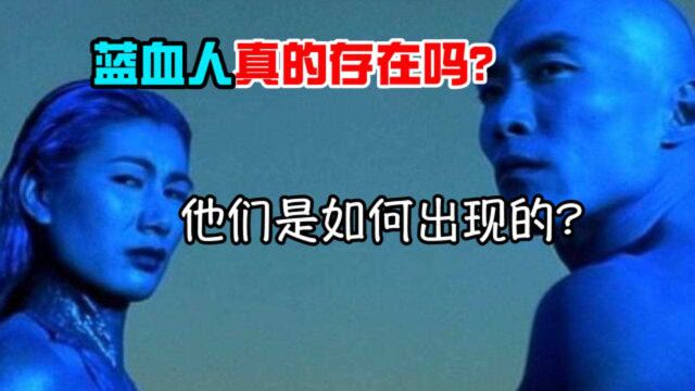 现实生活中蓝血人真的存在吗? 他们是天生如此,还是后天突变?