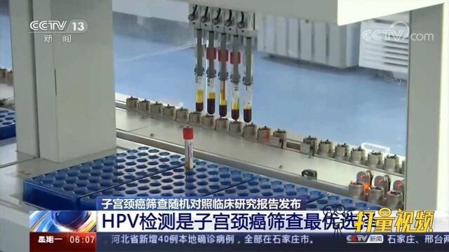 子宫颈癌筛查随机对照临床研究报告发布:HPV检测是筛查最优选择