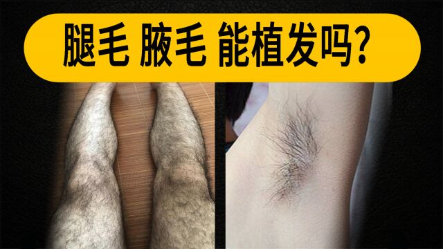 【冷知识】腿毛、腋毛可以给秃顶植发吗?