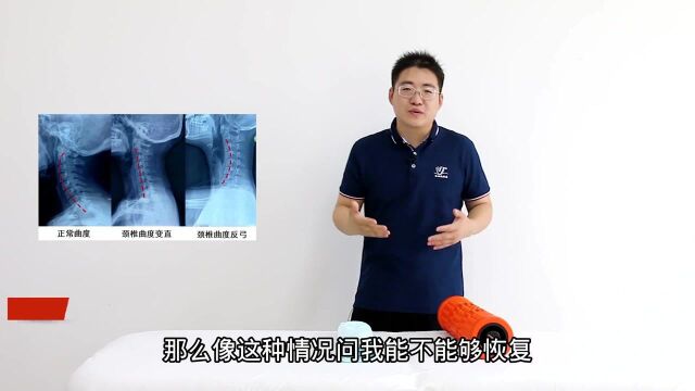 颈椎生理曲度变直还能恢复吗?别担心,不妨试着这样做,轻松改善