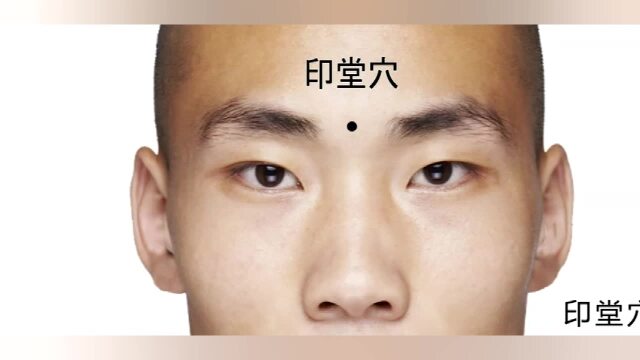 印堂穴,头疼,眩晕,失眠,高血压
