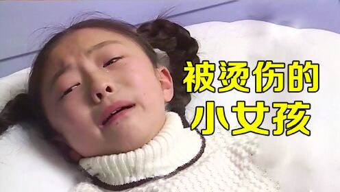 小女孩被高压锅烫伤，妈妈把皮肤移植给女儿，真是太感人了！