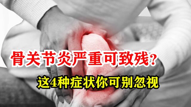 骨关节炎严重可致残?提醒:这4种症状,你可别忽视