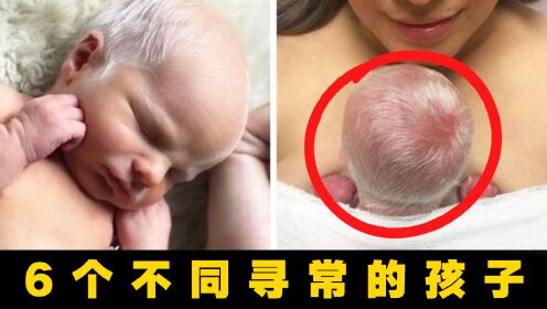 6个最与众不同的孩子！是什么让她红眼白发？