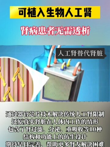 可植入生物人工肾,生病患者无需透析#肾内科杨剑辉#四川#社会百态