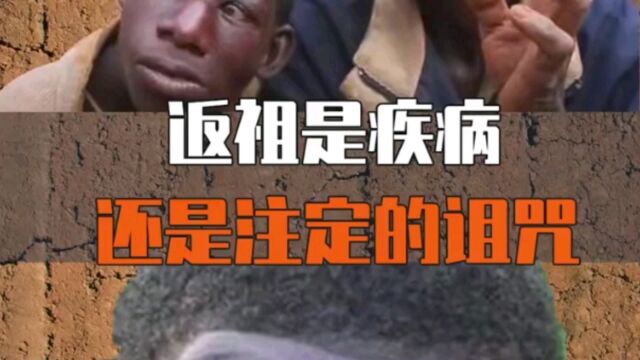 奇异的外貌,愿意吃草和发出猿猴的叫声,他就是非洲返祖男孩艾力