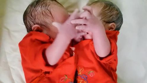 双胞胎新生儿不知自己已经出生，护士刚分开，又抱到了一起