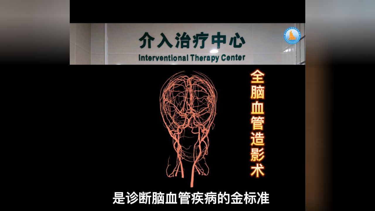 全脑血管造影术手术流程_高清