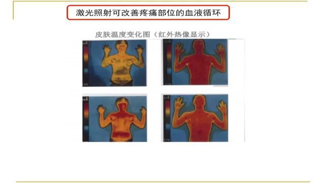 陈建平低强度激光的作用机理