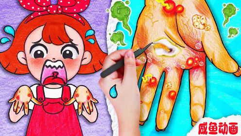 趣味定格动画：给小美受伤的小手做个手部护理，过程太治愈了！