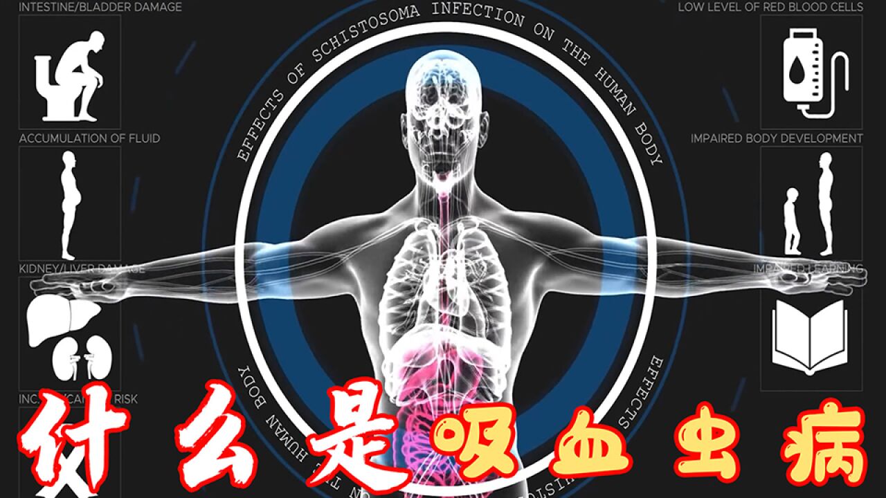 第12集 是什么引发的吸血虫病_高清1080P在线观看平台_腾讯视频
