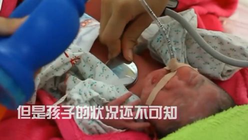 早产儿刚出手术室，呼吸十分困难，必须尽快转院救治