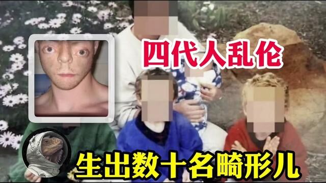 四代人乱伦生出数十名畸形儿 #真实案件 #人物故事 #记录片 #真实事件