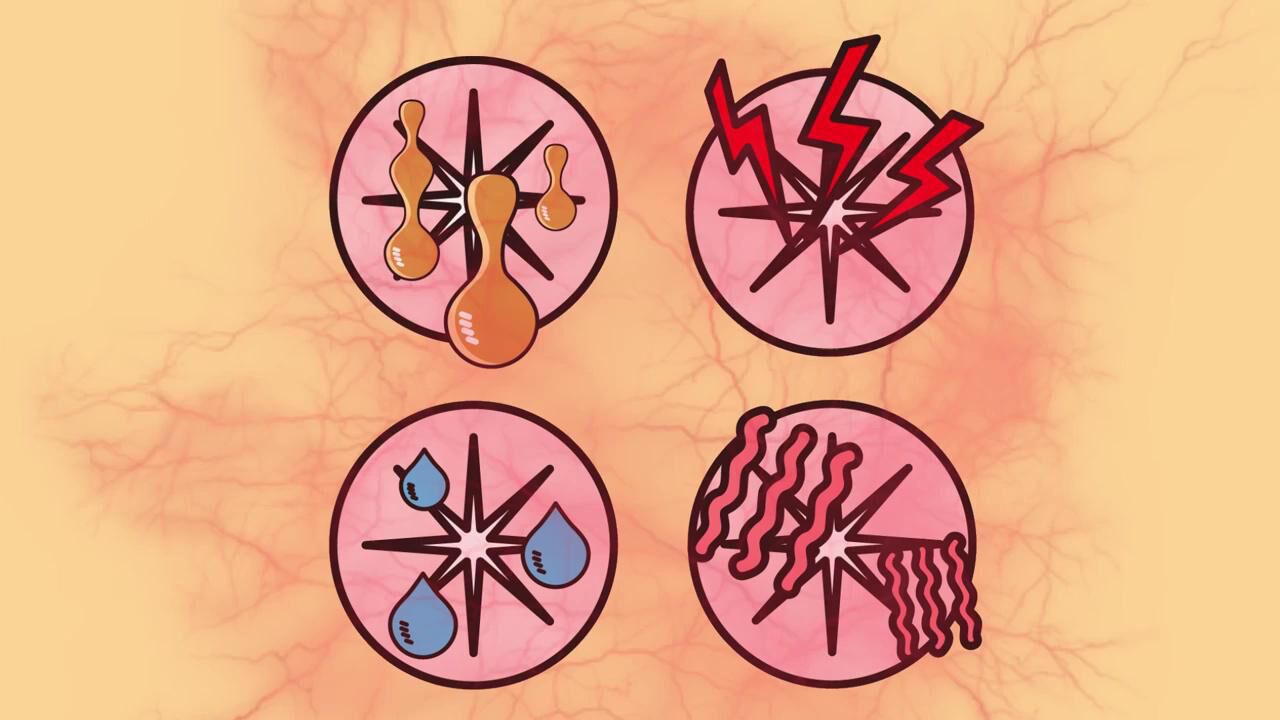 肛瘘是什么，看完就懂了_腾讯视频
