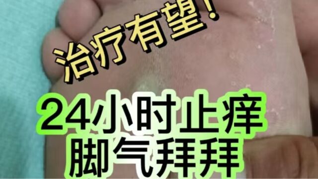 溃烂脚臭!女生得了脚气用了它,效果令人震惊!