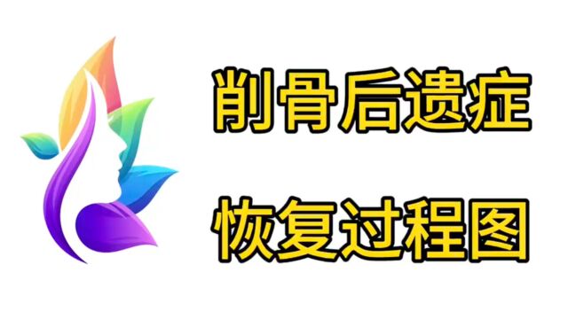 谁说的削骨后遗症非常多?磨骨恢复过程图一个月看过来!