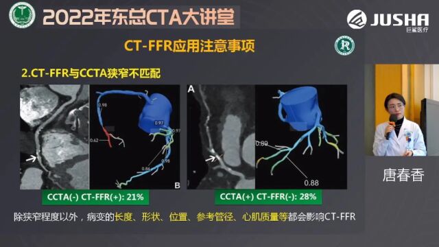 CTFFR技术规范及临床应用东部战区总医院唐春香