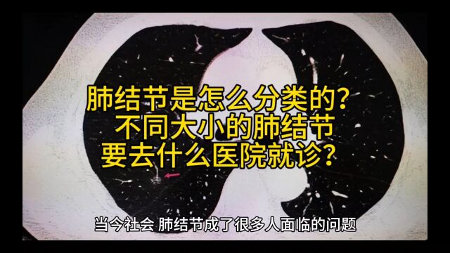 肺结节是怎么分类的?不同大小的肺结节要去什么医院就诊?