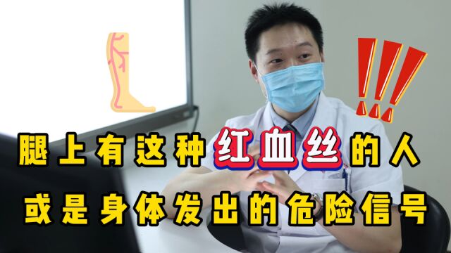 腿上有类似“红血丝”的人,要引起重视