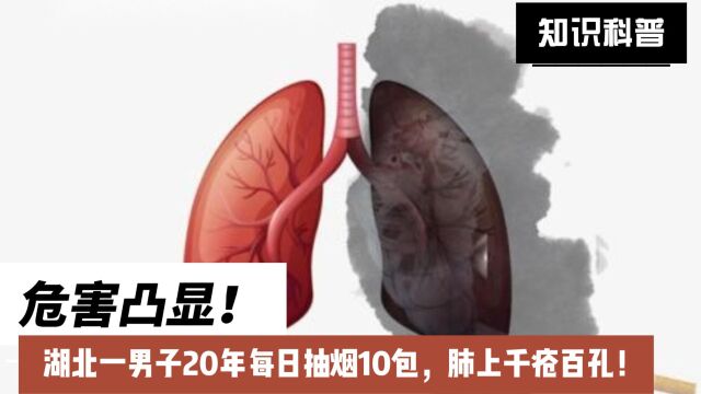 危害凸显!湖北一男子20年每日抽烟10包,肺上千疮百孔!