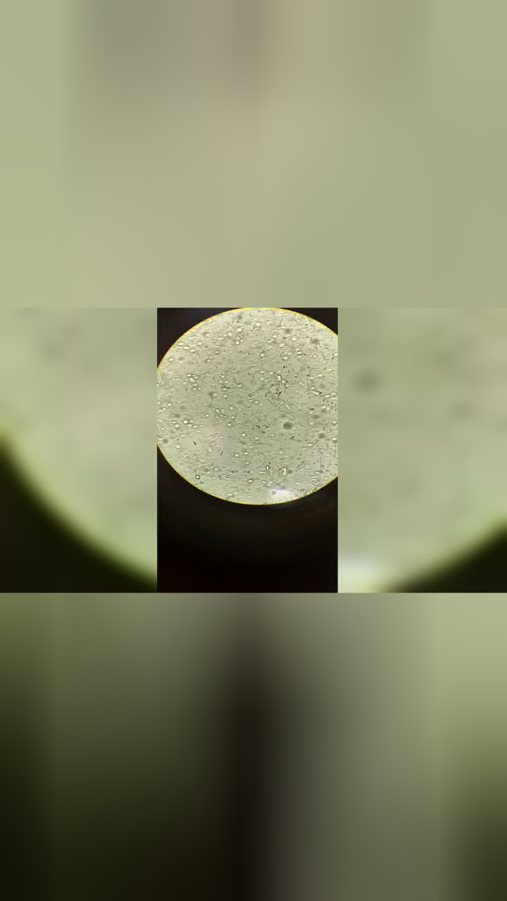 显微镜下的滴虫