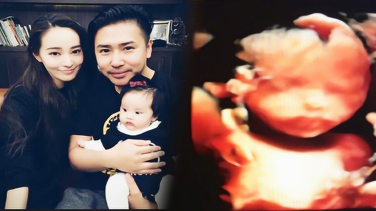 欧弟晒二胎b超照首次公开性别二胎女儿与妻子长得超像