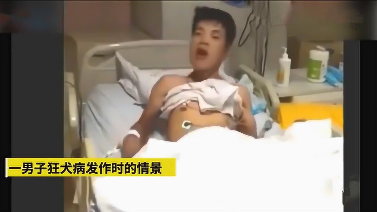 实拍人被狗咬后狂犬病发作全过程，惊悚_高清