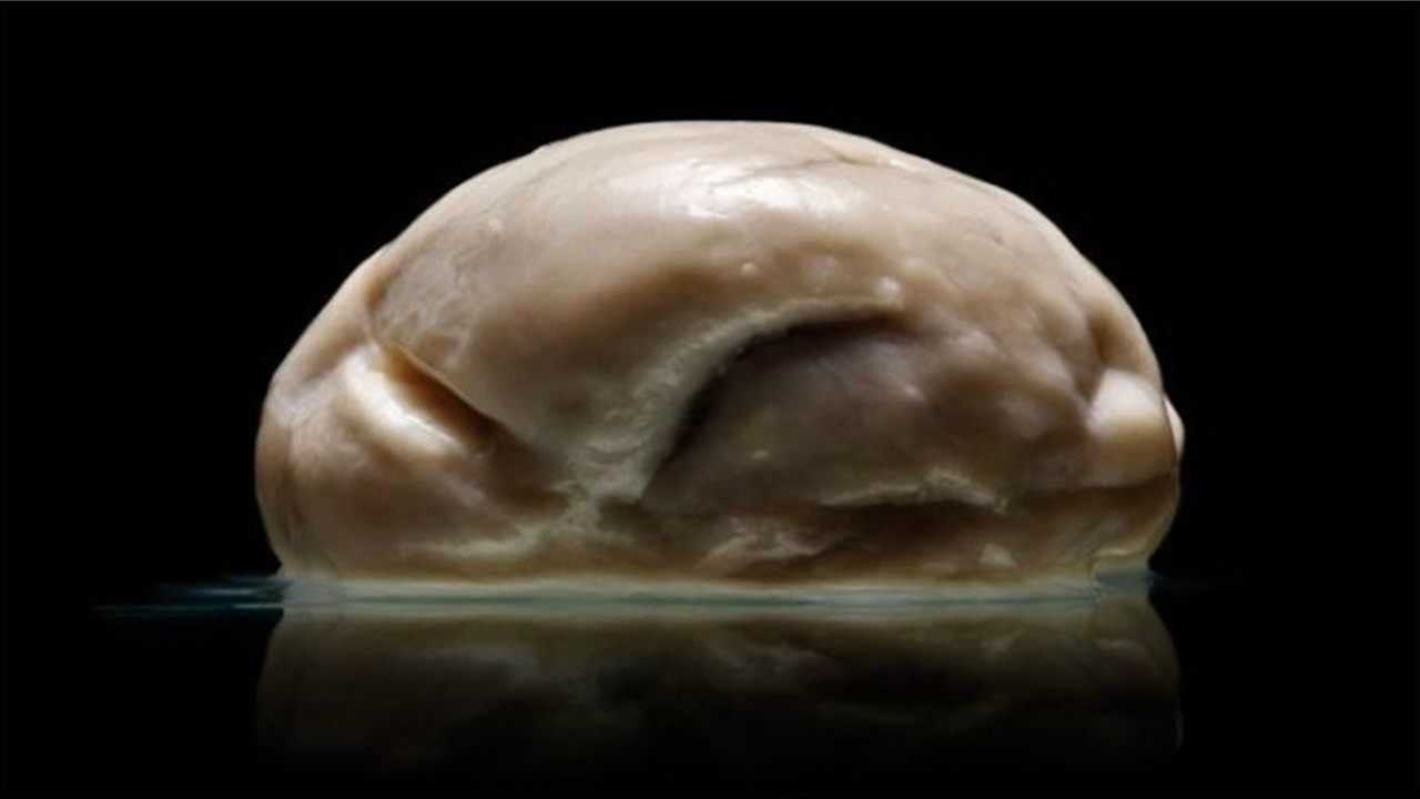 世界上最怪异的大脑,表面光滑无沟回,很多人没见过!