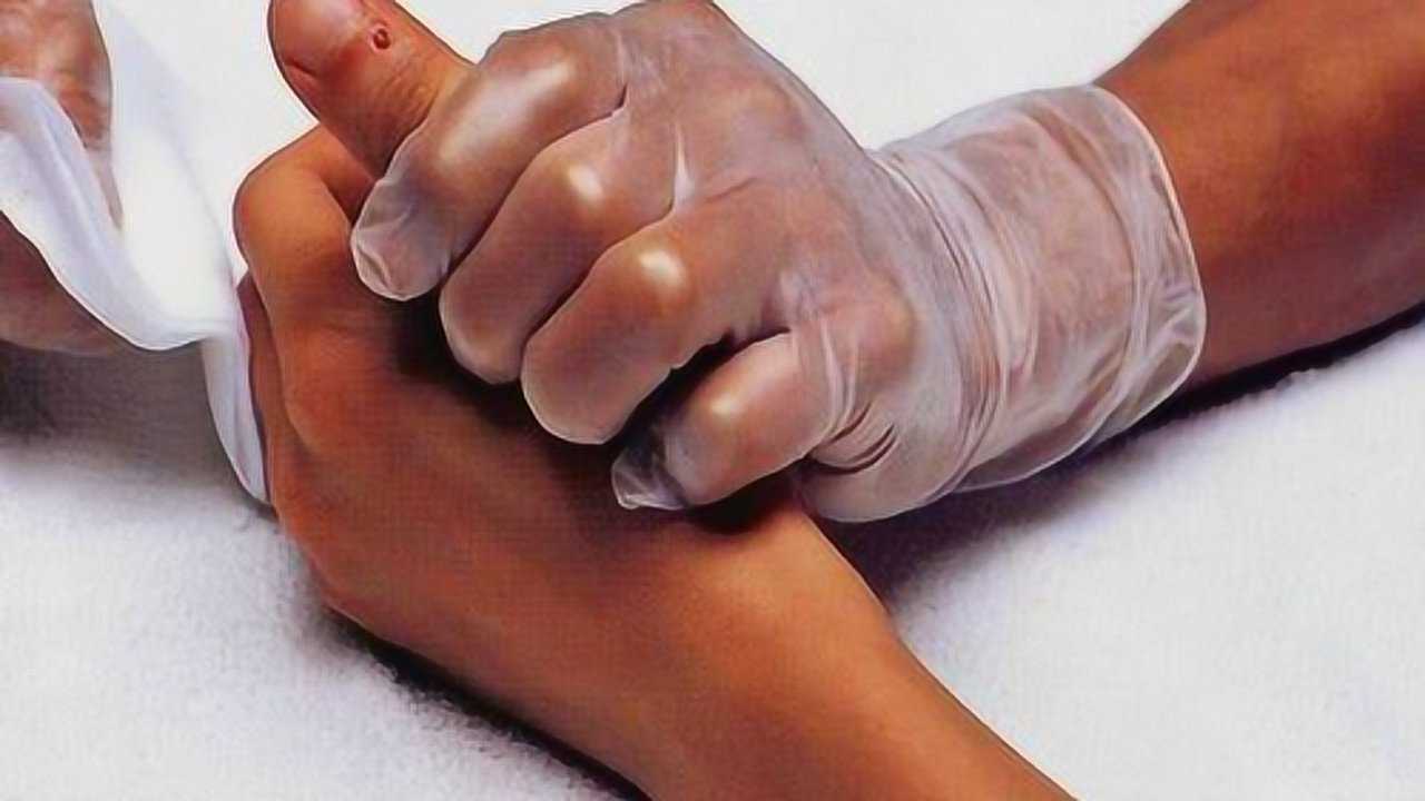 刺络放血治疗眼部疾病