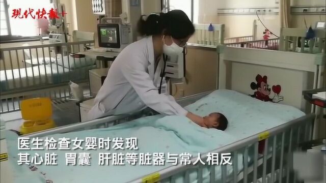 扬州女婴生病送医,父母才知是内脏长反的“镜面人”