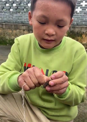 小孩子的手,曾经给电过,现在他都活不了了.