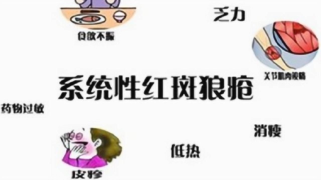 系统性红斑狼疮有哪些症状?