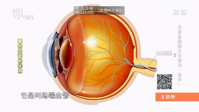 你知道视网膜的中央动脉在哪吗?专家借助模型进行分析,涨知识了