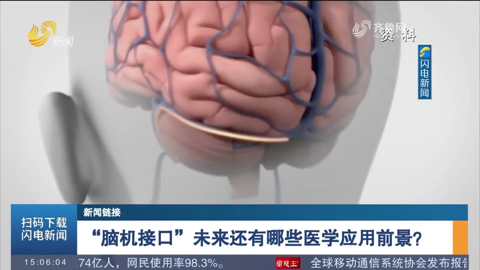 脑机接口未来还有哪些医学应用前景?北京宣武医院院长这样介绍