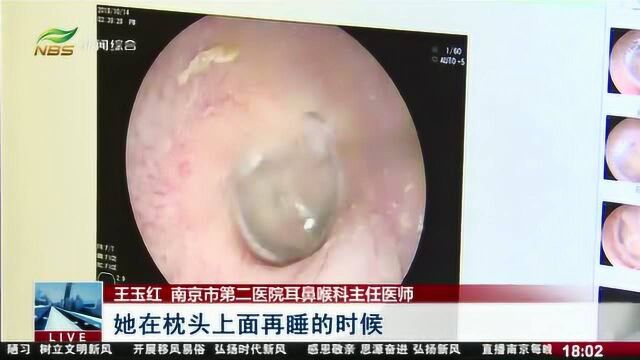 耳朵里为何会“沙沙”作响?原来是猫虱在爬行