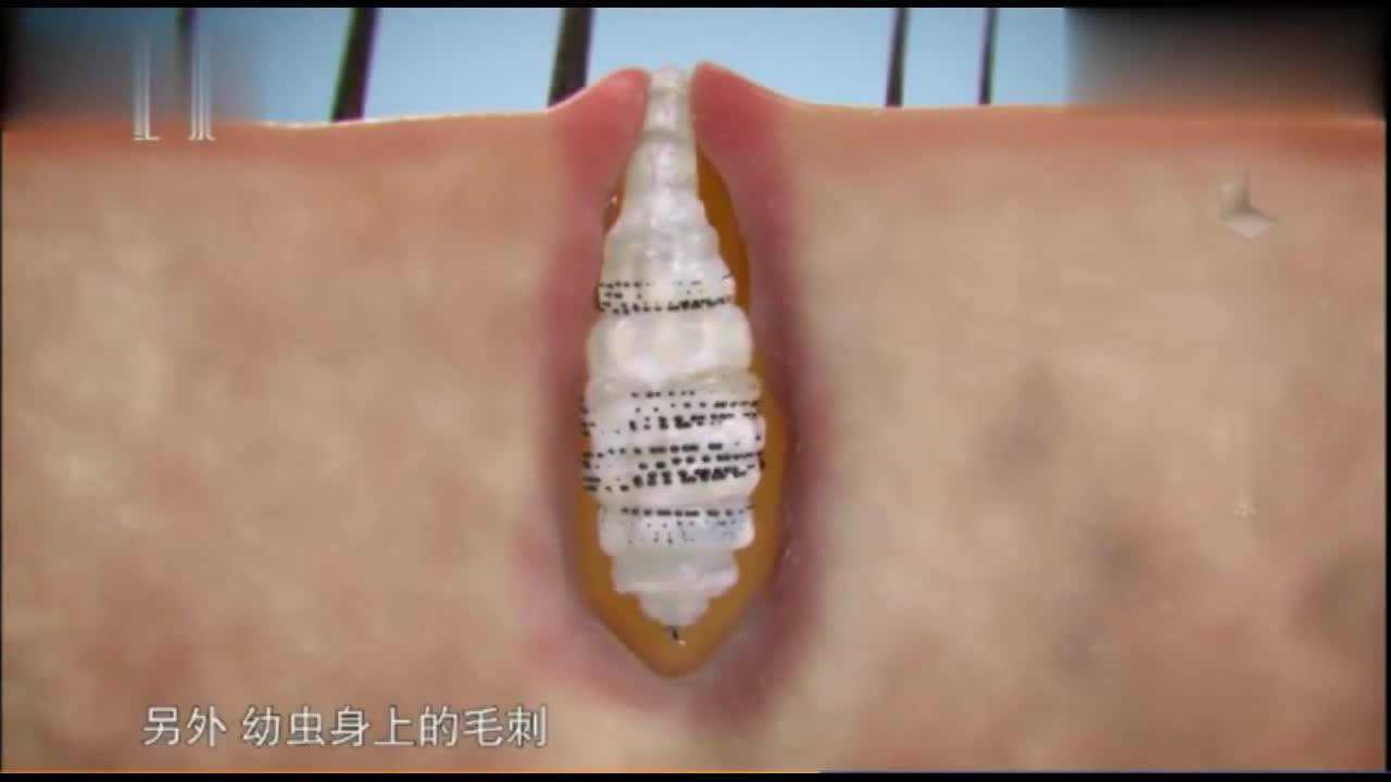 专门把幼虫寄生在人体的人肤蝇，看一下寄生的蛀虫成长的整个过程_高清